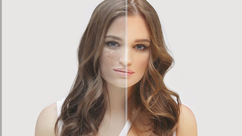 Skin lightening cost in surat explained  breaking down consultation  sessions   results